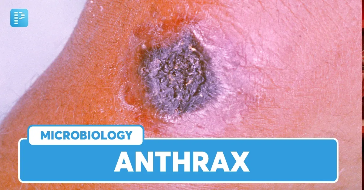 Anthrax infection